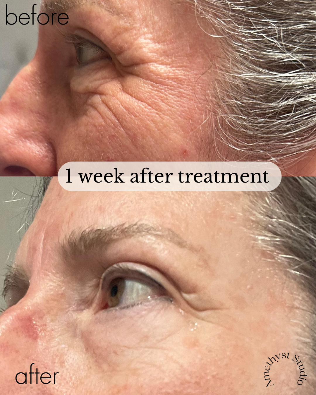 Client transformation 2