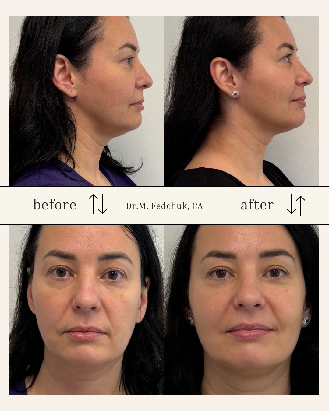 Client transformation 4