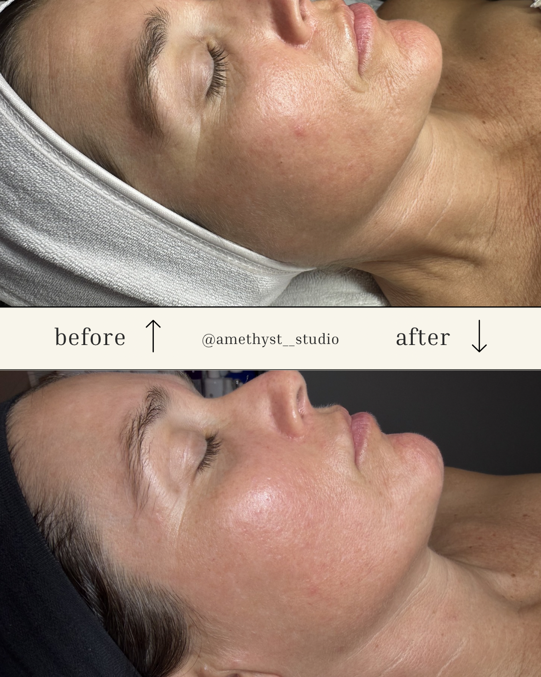 Client transformation 7