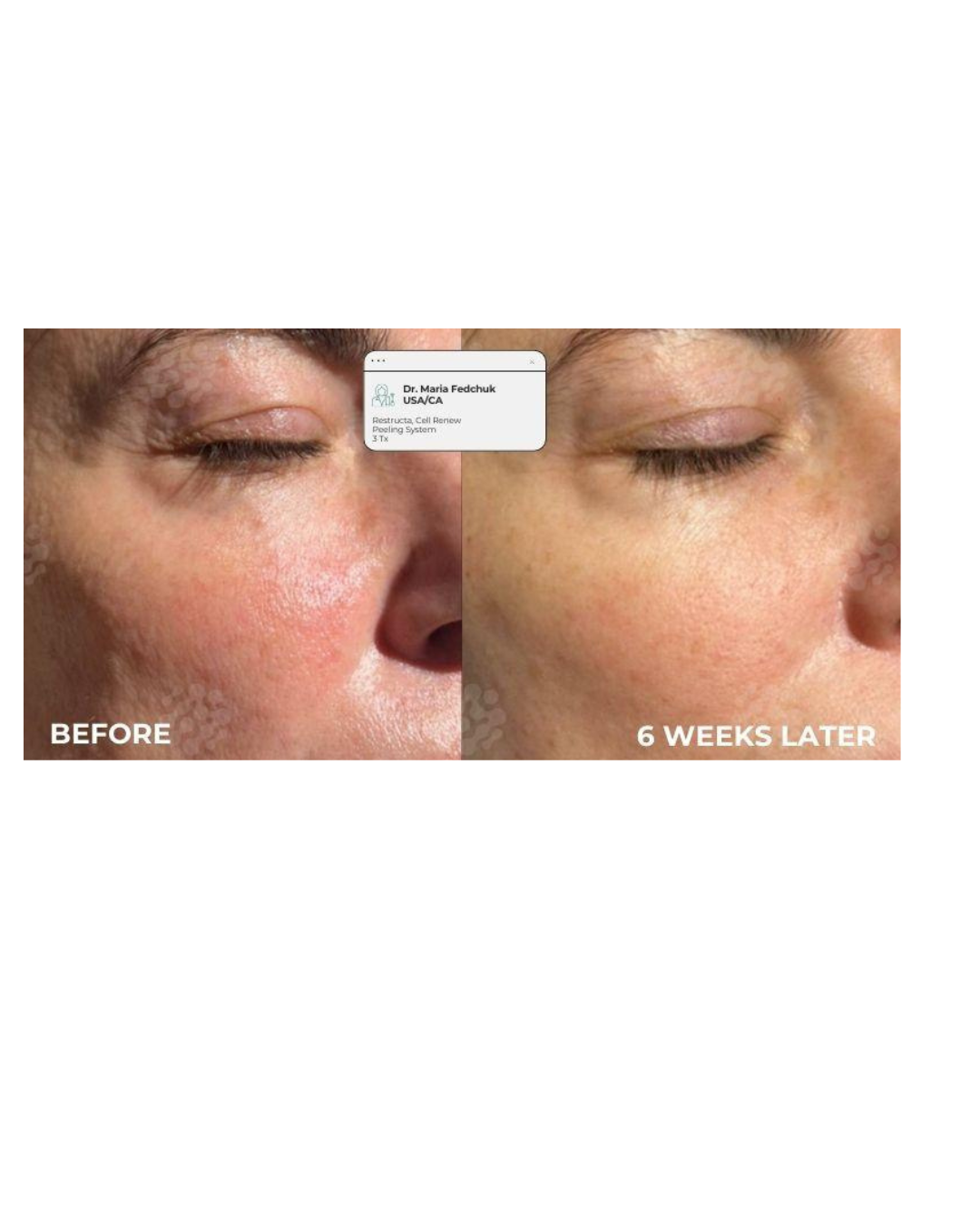 Client transformation 9